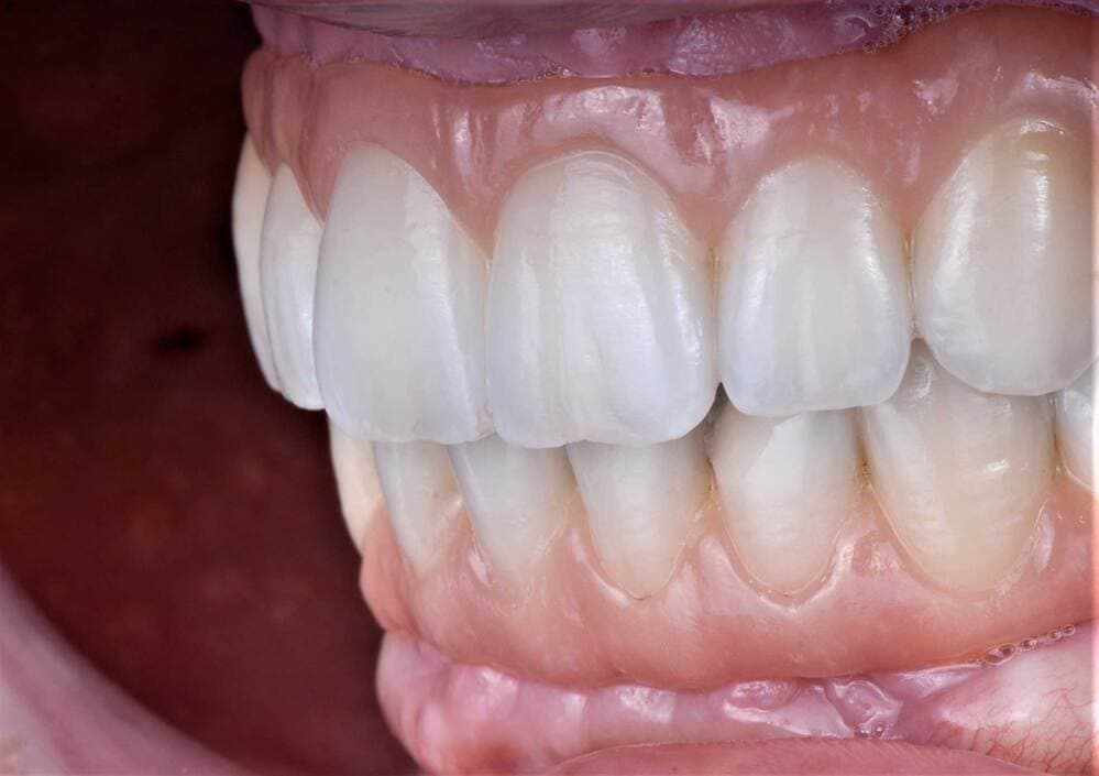 lourdes dientes 1